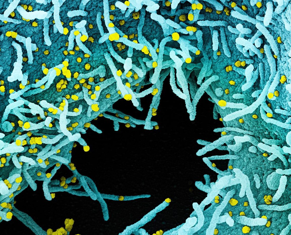 A OMS alertou que o novo coronavírus não tem características sazonais e fez um alerta sobre pensar em ondas quando se fala da pandemia de Covid-19.
