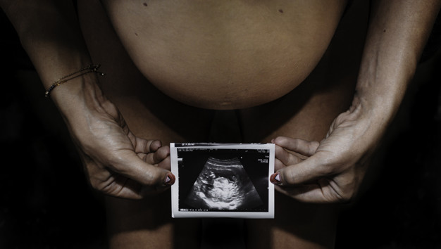 projeto - esterilização