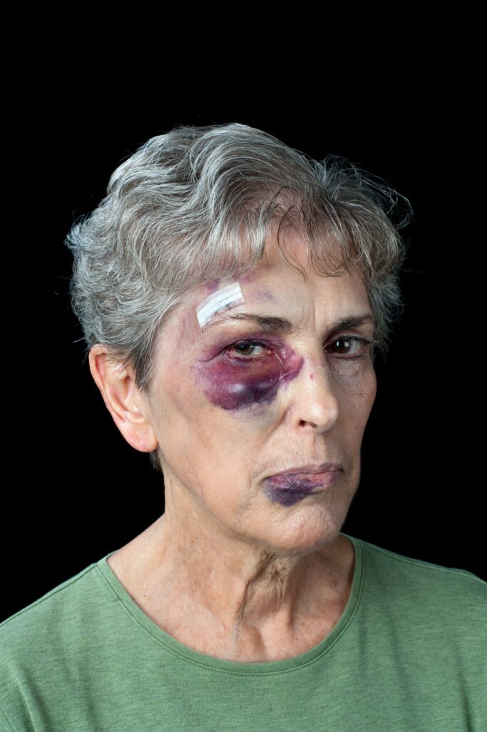 Beaten elderly woman