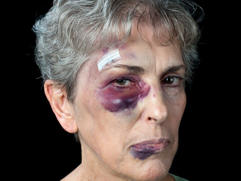 Beaten elderly woman